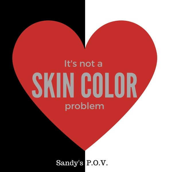 Image-Its-not-a-skin-color-problem